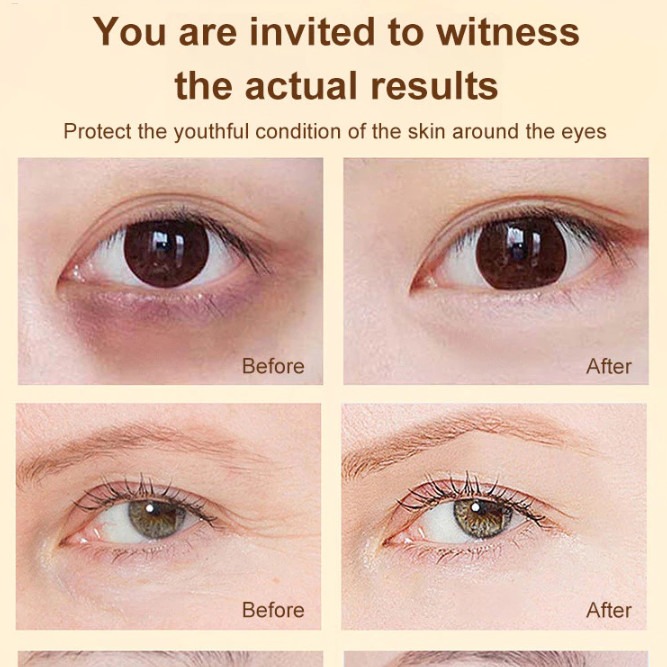 Óleo para Olhos de Luteína VC – Hidratação Profunda e Ação Antienvelhecimento