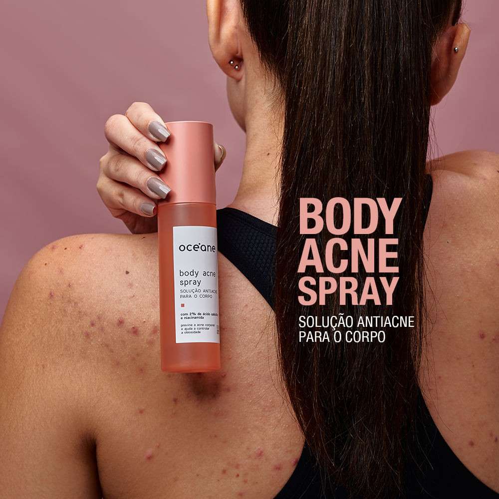 Body Acne Spray: Pele Lisa e Sem Acne!