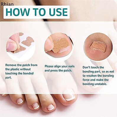 Rhian 100 Unidades – Adesivo para Fungos e Unhas Encravadas
