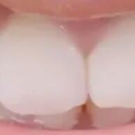 100 Palitos Interdentais: Sorriso Limpo e Saudável! - imagem 1