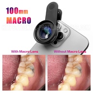 Lente Macro 100mm: Fotos Incríveis com seu Celular! - imagem 2