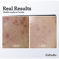 CELLADIX Skin Balancing Ph 5,5 131 Toner Mist – Hidratação e Equilíbrio Facial em 120ml - imagem 2