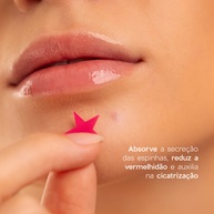 Adesivos com Ácido Salicílico para Espinhas: Star Acne Patches 4you - imagem 2
