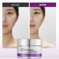 VT Cosmetics Reedle Shot: Lifting Facial em 50ml - imagem 2