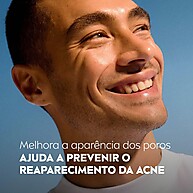 Nivea Acne Control: Limpeza Profunda para uma Pele Livre de Acne - imagem 2