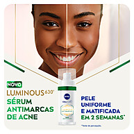 NIVEA Sérum Luminous 630®: Elimine Marcas de Acne - imagem 2