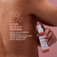 Body Acne Spray: Pele Lisa e Sem Acne! - imagem 2