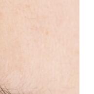 anvisa-com-medica-qualidade-018mm-18u-blade-nano-lovbeauty-laminas