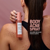 Body Acne Spray: Pele Lisa e Sem Acne! - imagem 1