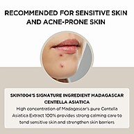 SKIN1004 Centella Asiatica – Hidratação Pura e Calmante - imagem 2