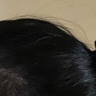Kit 24 Elásticos de Cabelo com Laço: Elegância Casual - imagem 2