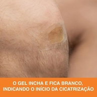 Nexcare Cicatrização Avançada: Kit com 12 Curativos - imagem 2
