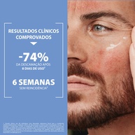 Kelual DS Ducray: Adeus Descamação Facial! - imagem 2