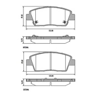 Disco de Freio Dianteiro Ventilado Hipper para Hyundai HB20 1.0 (2013+) - Segurança e Performance - imagem 5