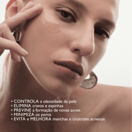 Beyoung Acne Control: Sérum Antiacne para Pele Livre de Imperfeições - imagem 2