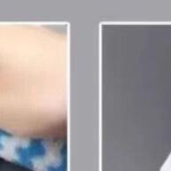 insetos-e-entupimentos-adeus