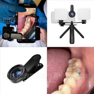 Lente Macro 100mm: Fotos Incríveis com seu Celular! - imagem 4