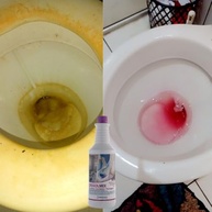 Limpa Vasos Sanitários Dissolmix 2L - Remove Sujeiras e Encardido com Poder de Limpeza Profundo - imagem 4
