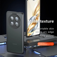 Capa Honor Magic 7 Lite: Proteção e Estilo! - imagem 2