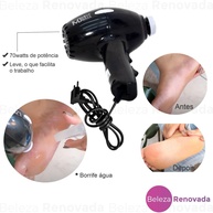 Lixa Elétrica Para Pés: Calos Nunca Mais! - imagem 2