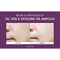 Vitamina K Dr.Ceuracle: Pele Radiante e Sem Manchas - imagem 2