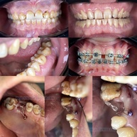 Luz Dental para Fotos: Kit Profissional - imagem 2