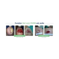 Gel de Limpeza Curatec 100ml - PHMB + EDTA para Higiene e Proteção Antimicrobiana - imagem 5