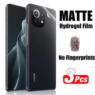 Película Hidrogel Matte: Proteção Total para Xiaomi! - imagem 1