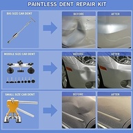 ROADGIVE Kit Completo 97 Peças: Reparo de Amassados Automotivos Sem Pintura - imagem 4