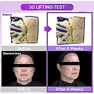 Bioheal Probioderm: Lifting 3D para uma Pele Radiante - imagem 2