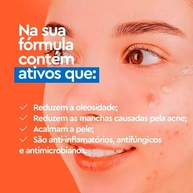 Acnezil Secativo: Elimine a Acne Rapidamente! - imagem 2