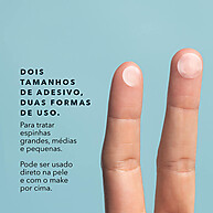 Acne Patches com Ácido Salicílico - Seca Espinhas Rápido! - imagem 2