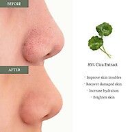 Cica Almofada Calmante: Pele Revitalizada! - imagem 2