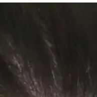 Shampoo Psoríase e Dermatite 500ml: Alívio Potente para Cabelos Sensíveis - imagem 2