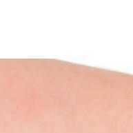 Removex Removedor de Curativos 30ml – Spray Livre de Éter para Peles Sensíveis - imagem 2
