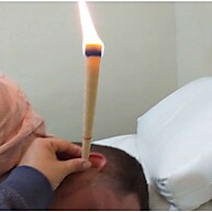 Limpeza de Ouvidos com Cone Hindu: Kit 12 Unidades - imagem 1