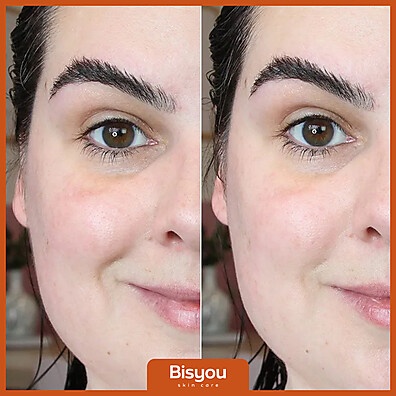 Bisyou: Clareador de Manchas Poderoso