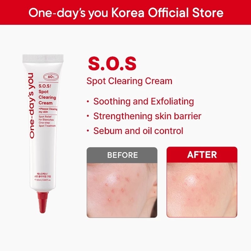 SOS Acne: Creme Facial One-Day's You 25ml
