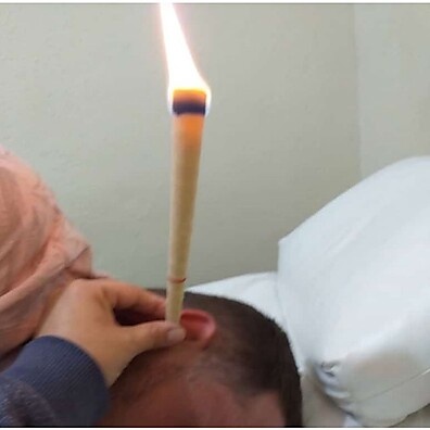 Limpeza de Ouvidos com Cone Hindu: Kit 12 Unidades